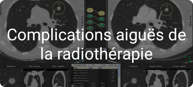 Quels sont les effets secondaires aiguës de la radiothérapie?